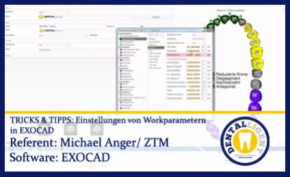 TIPPS & TRICKS - Einstellungen in den Workparametern von EXOCAD 