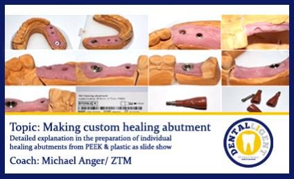 Topic: Making custom healing abutment 