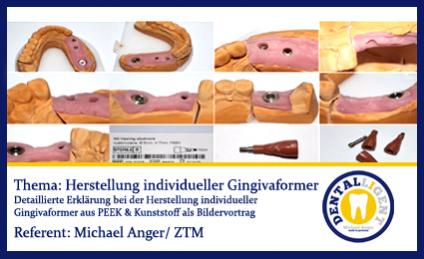 TIPPS & TRICKS - Herstellung individueller Gingivaformer 