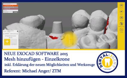 Mesh hinzufügen am Beispiel einer Einzelkrone - Exocad 2015 