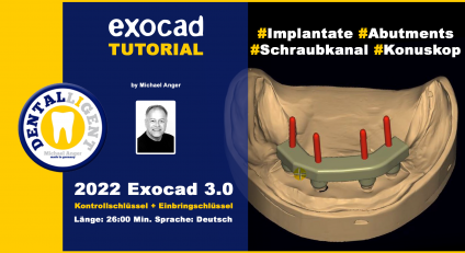 2022-Exocad - Exocad 3.0 – Kontrollschlüssel + Einbringschlüssel 