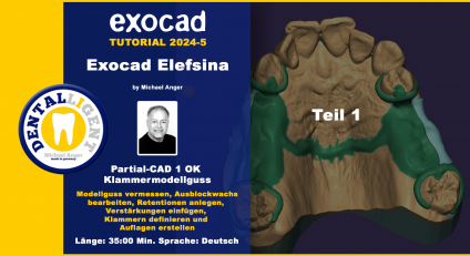 Exocad Elefsina 2024-5 Partial-CAD 1 OK Klammermodellguss Teil 1 