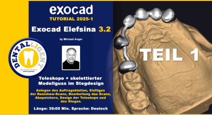 Exocad Elefsina 3.2 - 2025-1 - Teleskope + skelettierter Modellguss im Stegdesign TEIL 1 