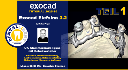 Exocad Elefsina 3.2 - 2025-10 - UK Klammermodellguss mit Schubverteiler TEIL 1 