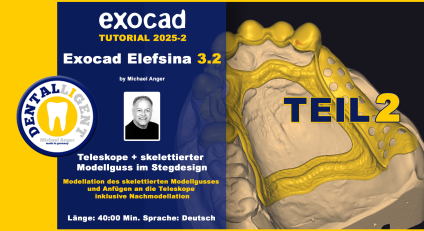 Exocad Elefsina 3.2 - 2025-2 - Teleskope + skelettierter Modellguss im Stegdesign TEIL 2 