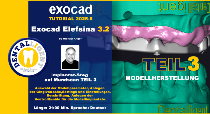 Exocad Elefsina 3.2 - 2025-6 - Implantat Steg auf Mundscan Teil 3 