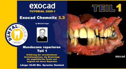 Exocad Chemnitz 3.3 - 2026-01 - Mundscans reparieren Teil 1 