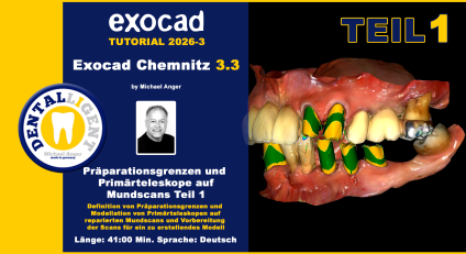 Exocad Chemnitz 3.3 - 2026-03 - Präparationsgrenzen und Primärteleskope auf Mundscans - Teil 1 