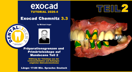 Exocad Chemnitz 3.3 - 2026-04 - Präparationsgrenzen und Primärteleskope auf Mundscans - Teil 2 