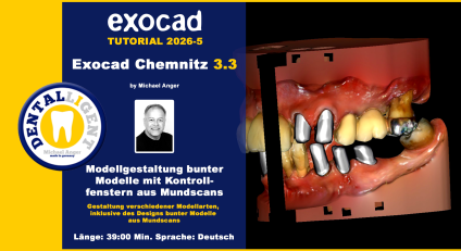 Exocad Chemnitz 3.3 - 2026-05 - Modellgestaltung bunter Modelle mit Kontrollfenstern aus Mundscans 
