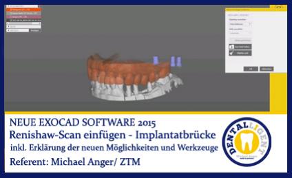 2015-Renishaw-Scan einfügen (Beispiel Implantatbrücke) - Exocad 2015 