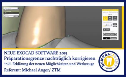 2015-Präparationsgrenze nachträglich korrigieren - Exocad 2015 