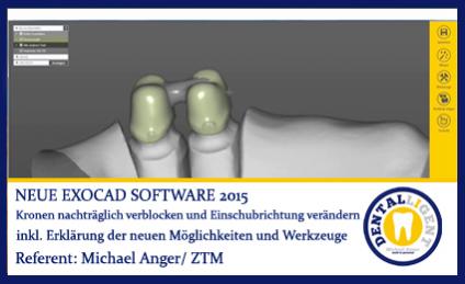 2015-Kronen nachträglich verblocken und Einschubrichtung verändern - Exocad 2015 