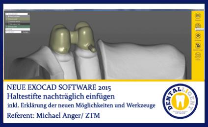 2015-Haltestifte nachträglich einfügen - Exocad 2015 