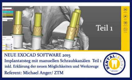 2015-Implantatsteg mit manueller Schraubkanalpositionierung Teil 1 - Exocad 2015 