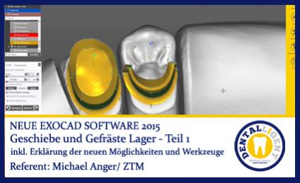 2015-Geschiebe und Gefräste Lager - Teil 1 - Exocad 2015 