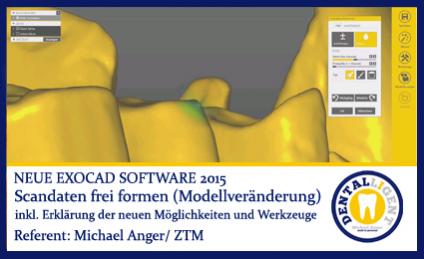2015-Scandaten frei formen (Modellveränderung) - Exocad Software 2015 