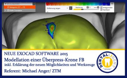 Modellation Überpresskronen 