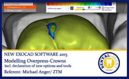 Modelling Overpress-Crowns 