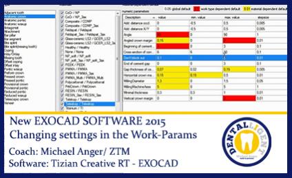 Changing settings in the Work-Params 
