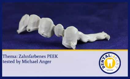 GRATIS - Innovation - Zahnfarbenes PEEK 