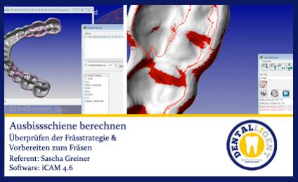 iCAM 4.6 Aufbissschiene berechnen 