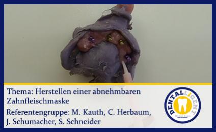 Herstellen einer abnehmbaren Zahnfleischmaske 
