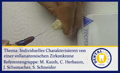 individuelles Charakterisieren einer vollanatomischen Zirkonkrone 